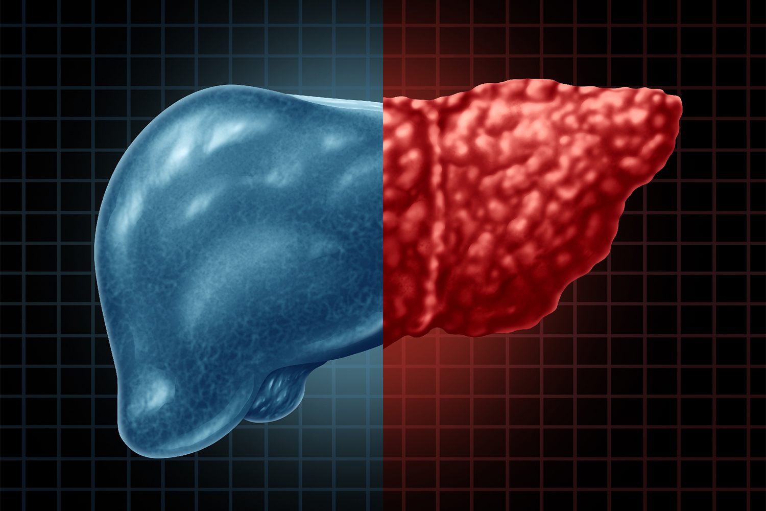 an illustration of a healthy liver compared to an unhealthy liver