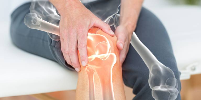 an inflammed knee joint