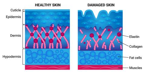 healthy skin vs damaged skin diagram