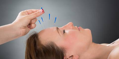 a woman getting acupuncture needles put in her forehead