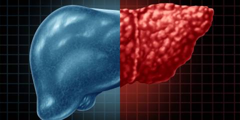 an illustration of a healthy liver compared to an unhealthy liver