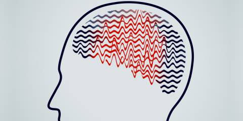 an illustration of erratic brainwaves