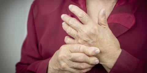 a woman with hands deformed by rheumatoid arthritis