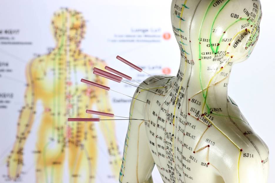 Acupuncture May Ease Hot Flashes Taste For Life