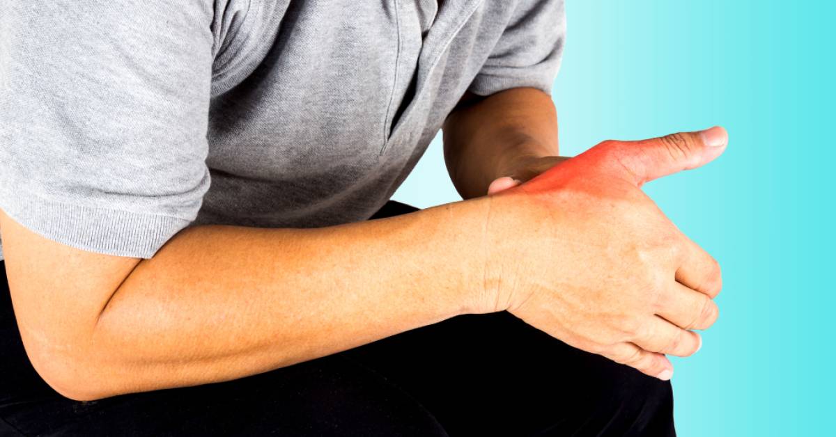 Thumb Tendonitis | Taste For Life