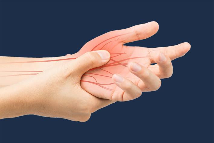 an illustration of nerves burning with pain in the hand and wrist