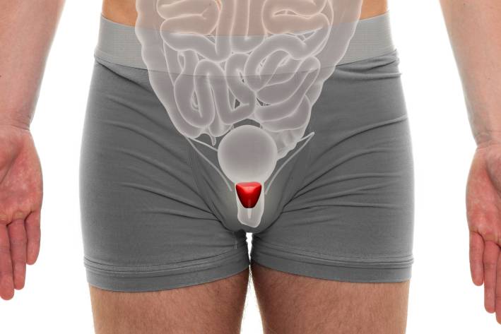 an illustration of male anatomy, with the prostate highlighted