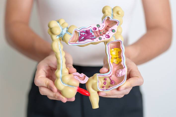 a woman holding a model of the large intestine