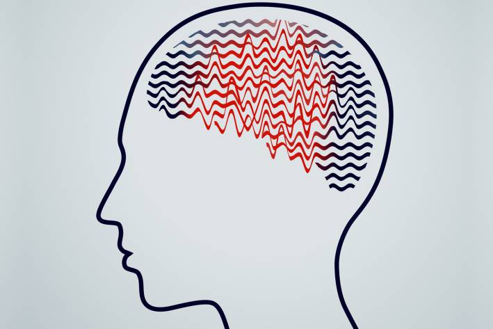 an illustration of erratic brainwaves