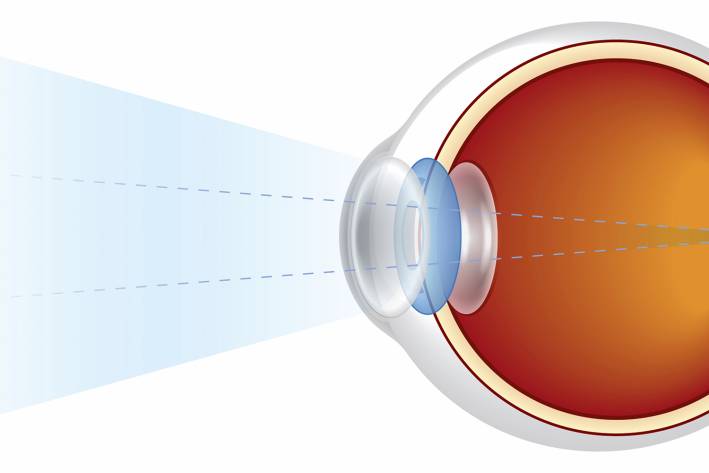 a diagram of the lens mechanism of the eye