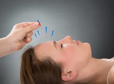 a woman getting acupuncture needles put in her forehead