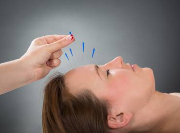 a woman getting acupuncture needles put in her forehead