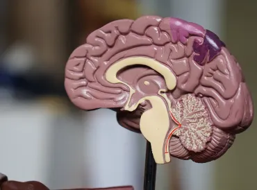 a model of a brain