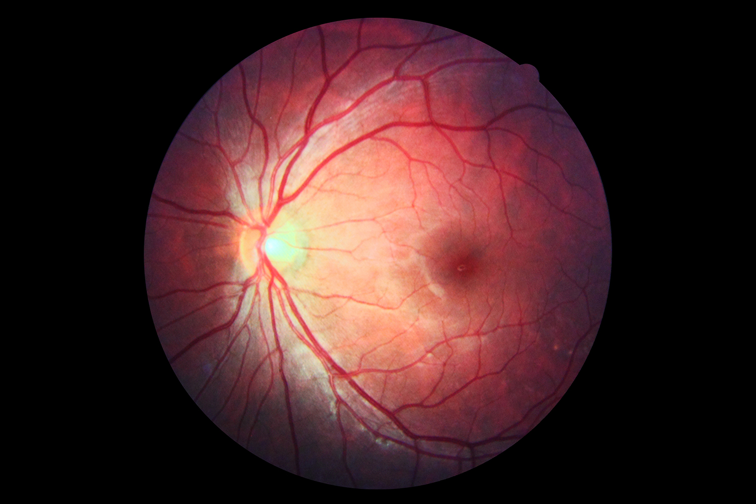 a photo of inside of the human eye